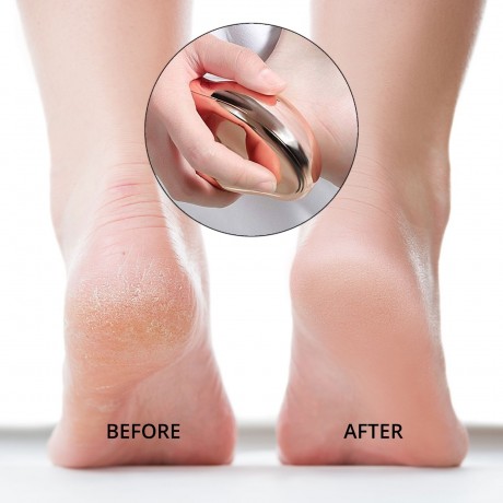 Ailoria Fuss Hornhautentferner  Средство для удаления мозолей на ногах