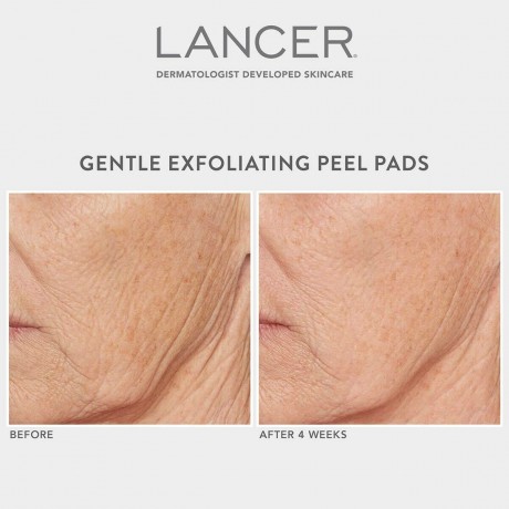 Lancer Gentle Exfoliating Peel Pads Нежные отшелушивающие подушечки для пилинга