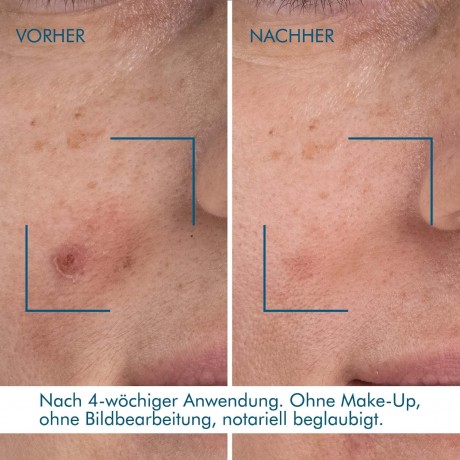 Biotherm Blue Retinol Resurface + Repair Night Serum  Blue Retinol Resurface + Восстанавливающая ночная сыворотка