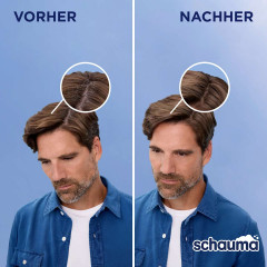 Schauma Shampoo Anti-Schuppen Classic, 400 ml, Schauma шампунь против перхоти Classic с алоэ вера и провитамином B5, 400 мл