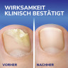 SCHOLL 2in1 Stift bei Nagelpilz, 3,8 ml, Шолль Средство от грибка ногтей 2в1, лечение и маскировка, 3,8 мл