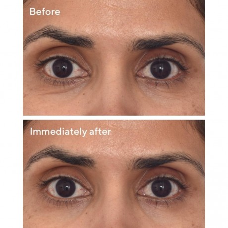 MURAD Retinol Youth Renewal Eye Masks Ретиноловые омолаживающие маски для глаз