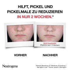 Neutrogena AHA/PHA/BHA Serum Сыворотка AHA/PHA/BHA