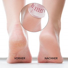 Ailoria Elektrischer Hornhautentferner (USB) schwarz  Электрическое средство для удаления мозолей (USB) черное