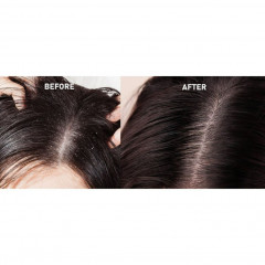 Rosinii Scalp Expert Lactic Acid + Urea Dry Scalp Soothing Treatment  Scalp Expert Молочная кислота + мочевина Успокаивающее средство для сухой кожи головы