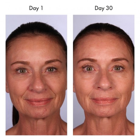 U BEAUTY Resurfacing Compound  Восстанавливающий состав