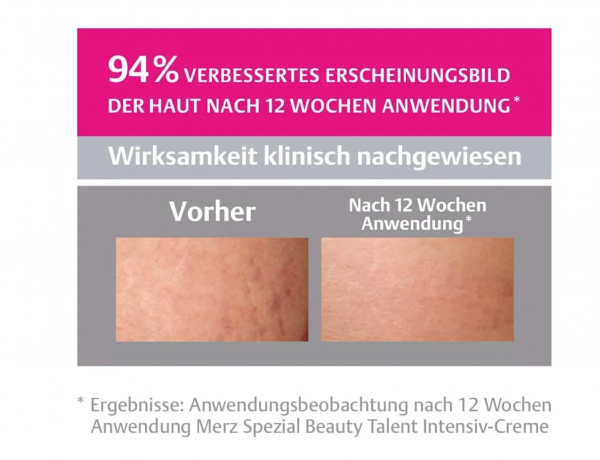 Merz Dehnungsstreifen Intensiv-Creme, Merz Spezial Интенсивный крем от растяжек кожи, 75 мл