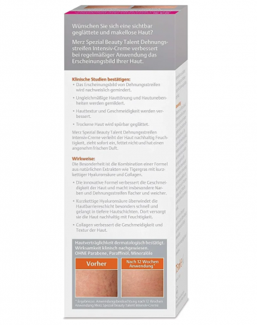 Merz Dehnungsstreifen Intensiv-Creme, Merz Spezial Интенсивный крем от растяжек кожи, 75 мл