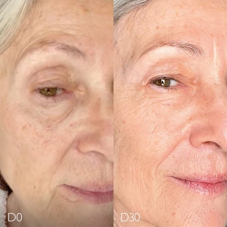 Caudalie Anti-Pigmentflecken Glykol-Nachtcreme Гликолевый ночной крем против пигментации