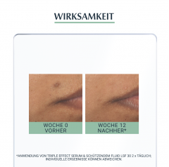 Eucerin DermoPure Triple Effect Serum  DermoPure Сыворотка с тройным эффектом