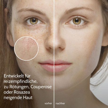 SALTHOUSE Anti-Roetungen Gesichtscreme LSF 50, 30 ml, SALTHOUSE тонированный крем Anti-Roetungen Gesichtscreme SPF 50 с зелёными пигментами, пантенолом и маслом ши против покраснений, 30 мл
