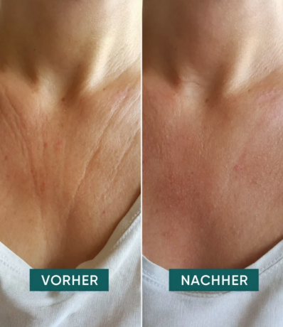 Apricot Decollete Pad Подушечка для декольте, 1 упаковка (30 штук)