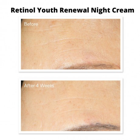 MURAD Retinol Youth Renewal Night Cream  Омолаживающий ночной крем с ретинолом