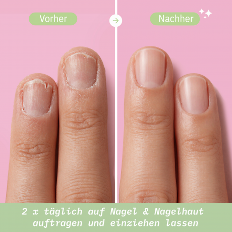 SANTE Stronger harder longer Nails Serum, 15 ml, Санте Сыворотка Stronger Harder Longer для укрепления и ухода за ногтями, 15 мл