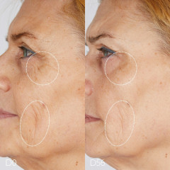 Caudalie Die Augencreme  Крем для глаз