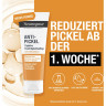 Neutrogena Anti-Pickel Taegliche Feuchtigkeitspflege, 50 ml, Neutrogena Anti-Pickel Ежедневный увлажняющий крем с 0,5% салициловой кислотой, алоэ вера и ромашкой, 50 мл