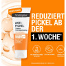 Neutrogena Anti-Pickel Pflegeset, 250 ml / 200 ml + 50 ml, Neutrogena Anti-Pickel Набор для кожи с высыпаниями: очищающий гель 200 мл и увлажняющий крем 50 мл
