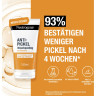 Neutrogena Anti-Pickel Taegliches Waschpeeling, 150 ml, Neutrogena Anti-Pickel Ежедневный очищающий пилинг с 2% салициловой кислотой BHA, 150 мл